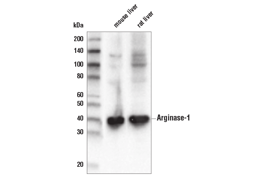 Western Blotting Image 2: Arginase-1 (D4E3M™) XP® Rabbit mAb (BSA and Azide Free)