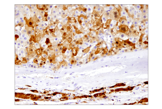 Immunohistochemistry Image 3: Arginase-1 (D4E3M™) XP® Rabbit mAb (BSA and Azide Free)