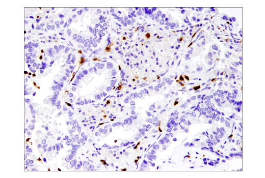 Immunohistochemistry Image 2: Arginase-1 (D4E3M™) XP® Rabbit mAb (BSA and Azide Free)