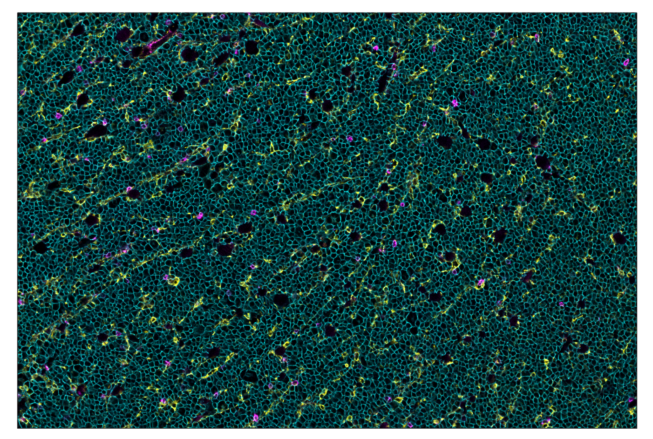 Immunohistochemistry Image 8: CD20 (E3N7O) & CO-0134-750 SignalStar™ Oligo-Antibody Pair