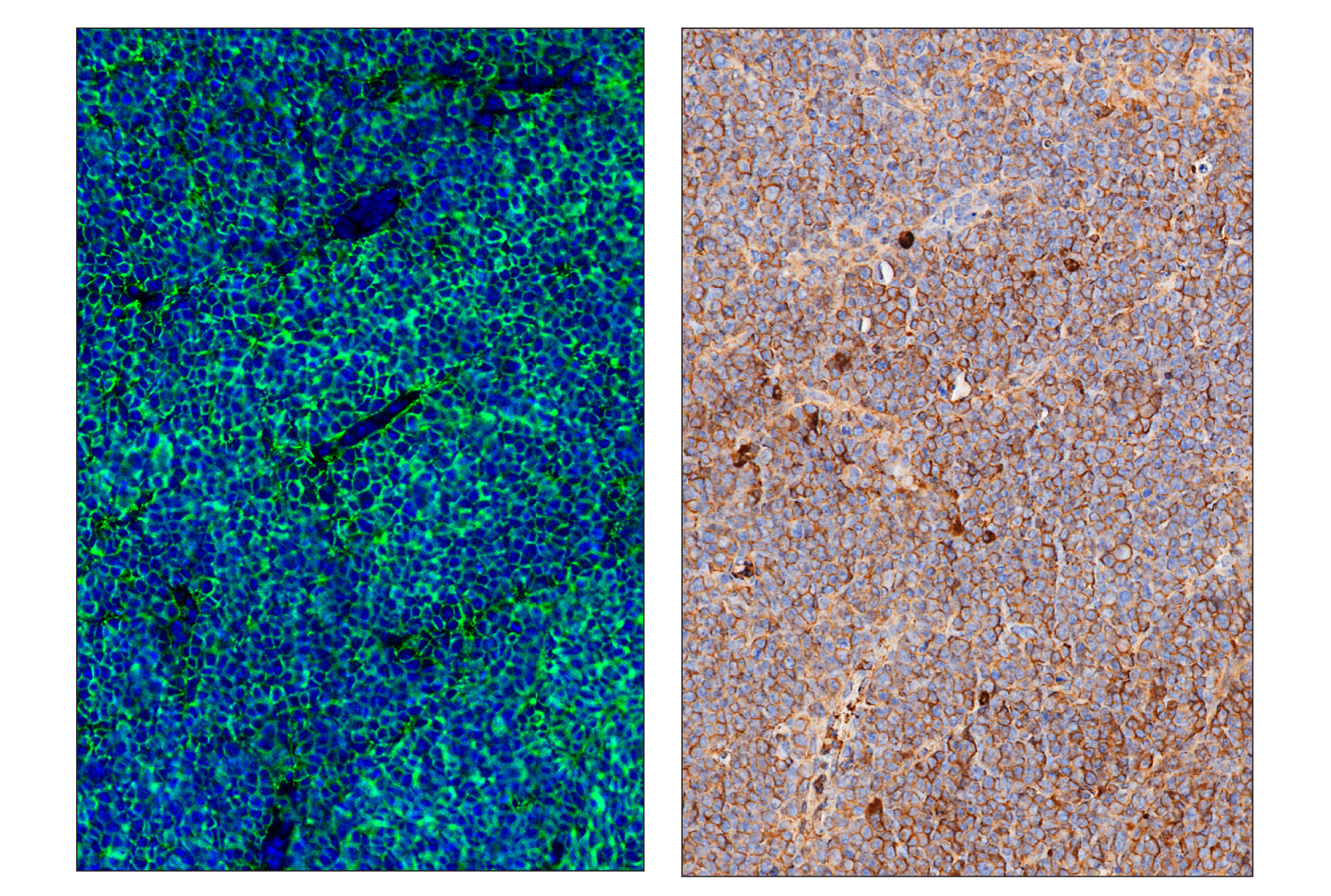 Immunohistochemistry Image 6: CD20 (E3N7O) & CO-0134-750 SignalStar™ Oligo-Antibody Pair