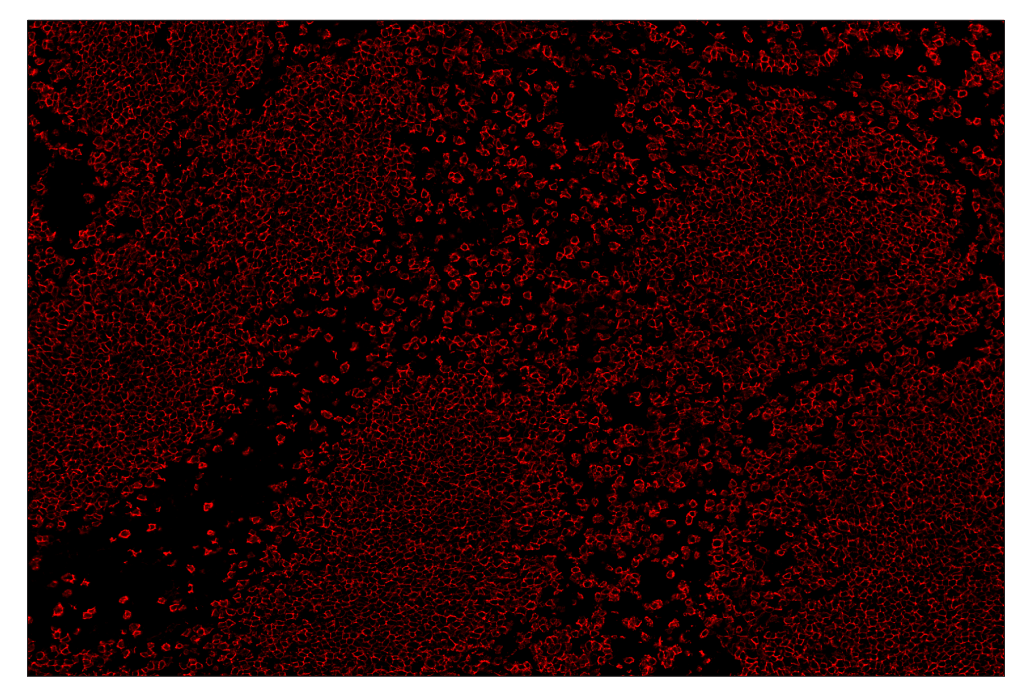 Immunohistochemistry Image 4: CD20 (E3N7O) & CO-0134-750 SignalStar™ Oligo-Antibody Pair