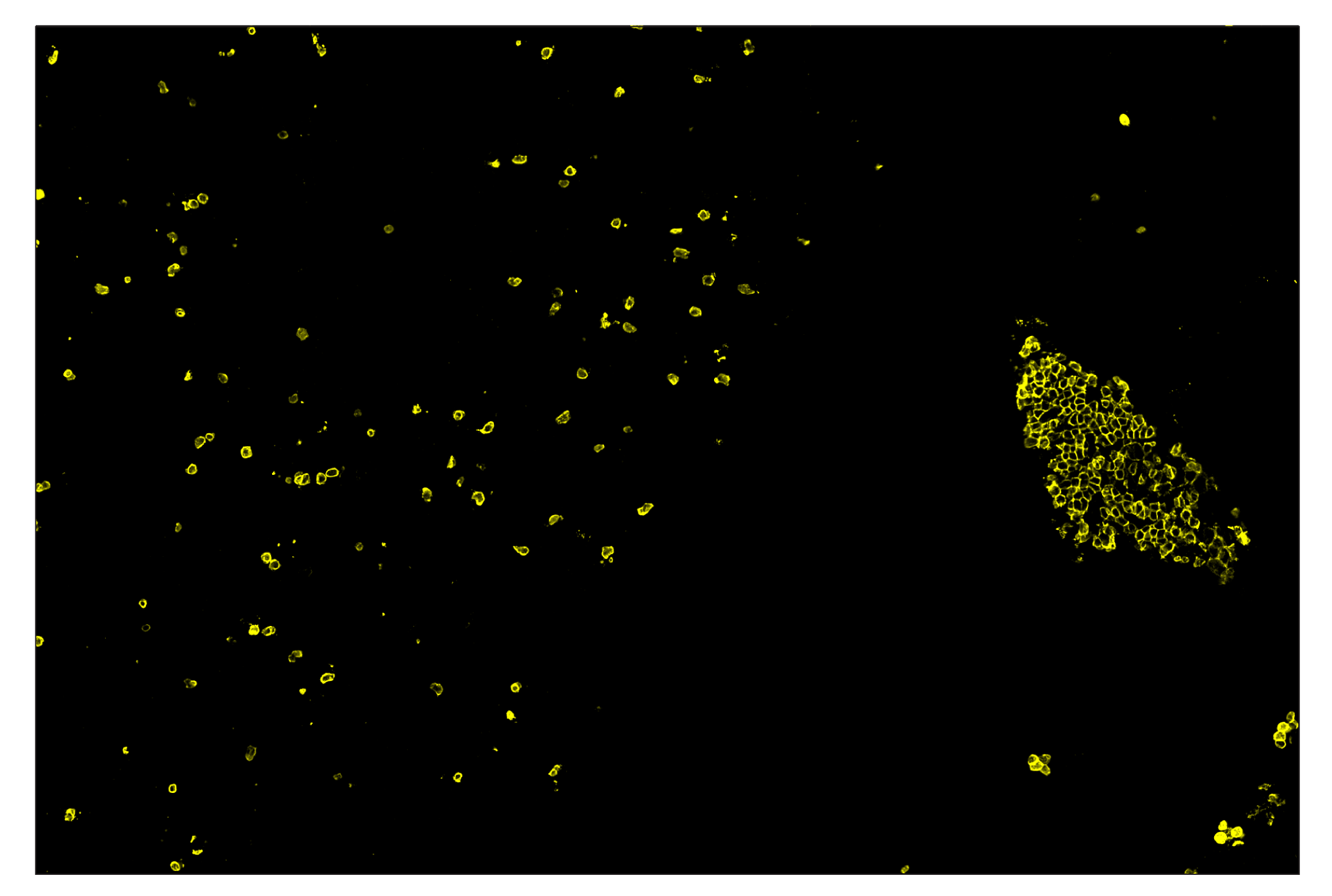 Immunohistochemistry Image 3: CD20 (E3N7O) & CO-0134-750 SignalStar™ Oligo-Antibody Pair