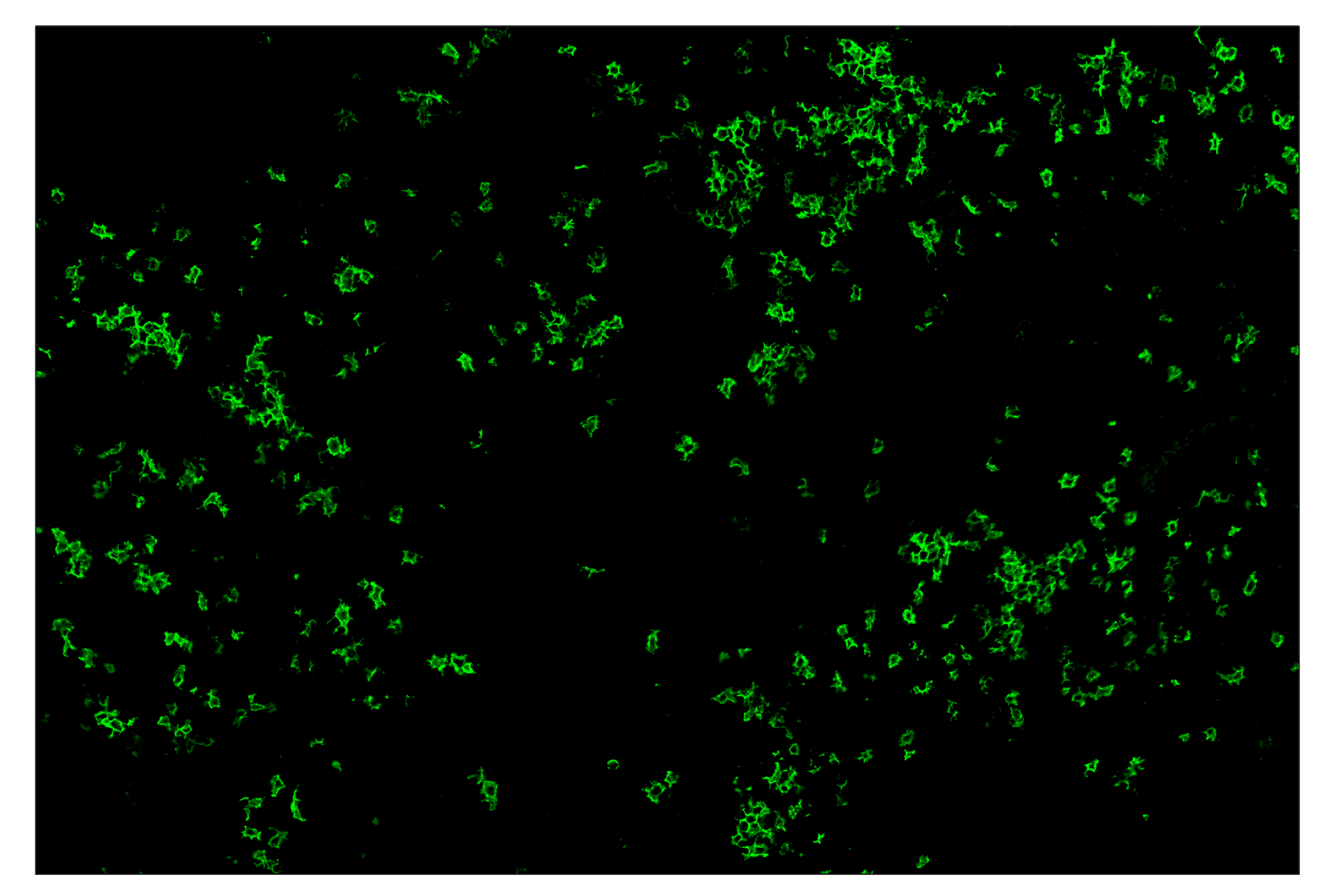 Immunohistochemistry Image 2: CD20 (E3N7O) & CO-0134-750 SignalStar™ Oligo-Antibody Pair