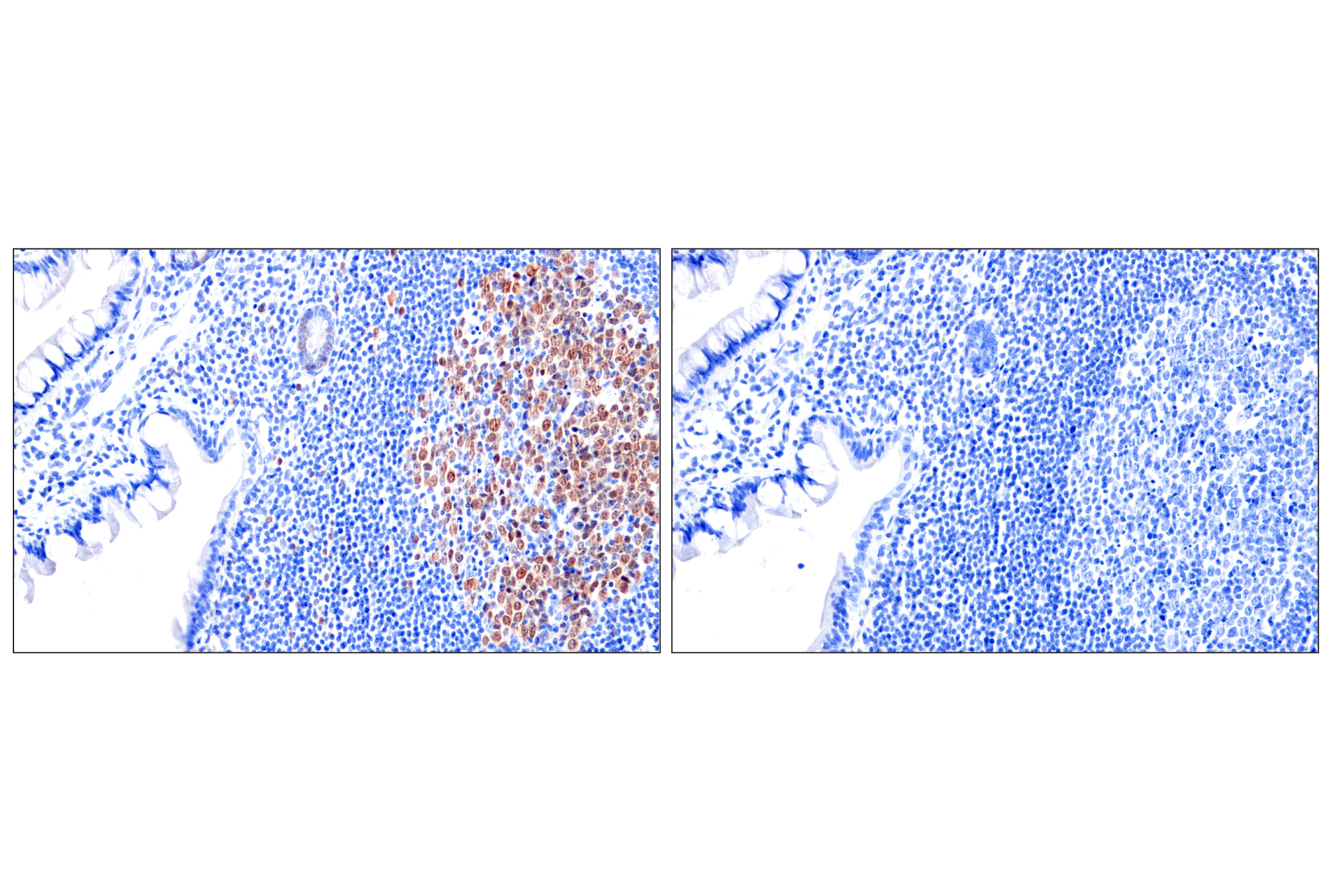 Immunohistochemistry Image 13: Chk1 (2G1D5) Mouse mAb (BSA and Azide Free)