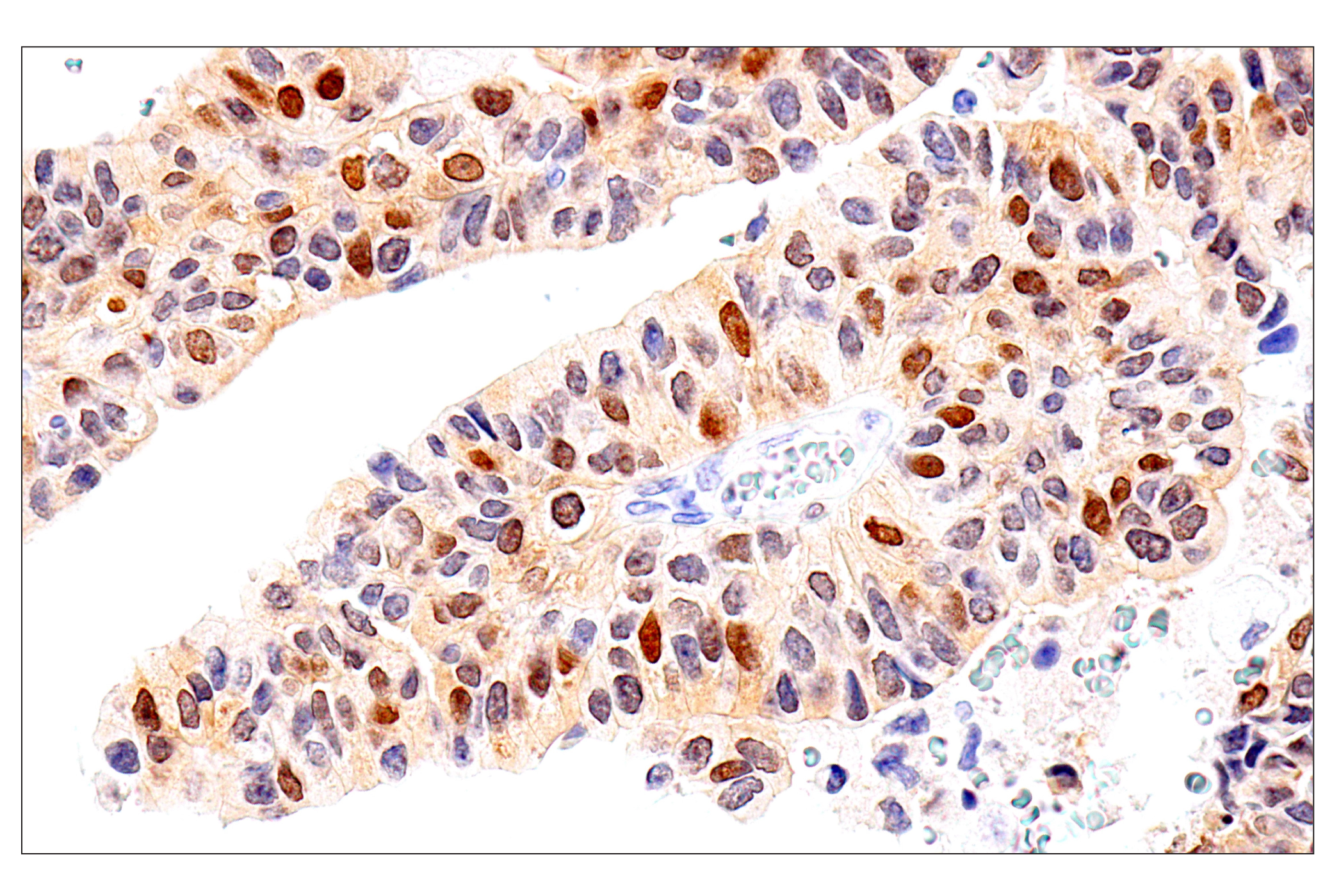 Immunohistochemistry Image 6: Chk1 (2G1D5) Mouse mAb (BSA and Azide Free)