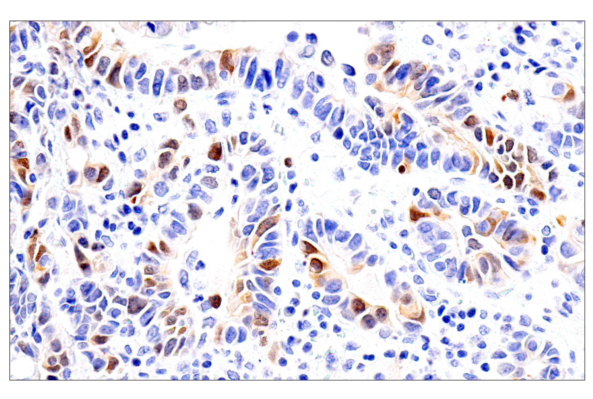 Immunohistochemistry Image 4: Chk1 (2G1D5) Mouse mAb (BSA and Azide Free)