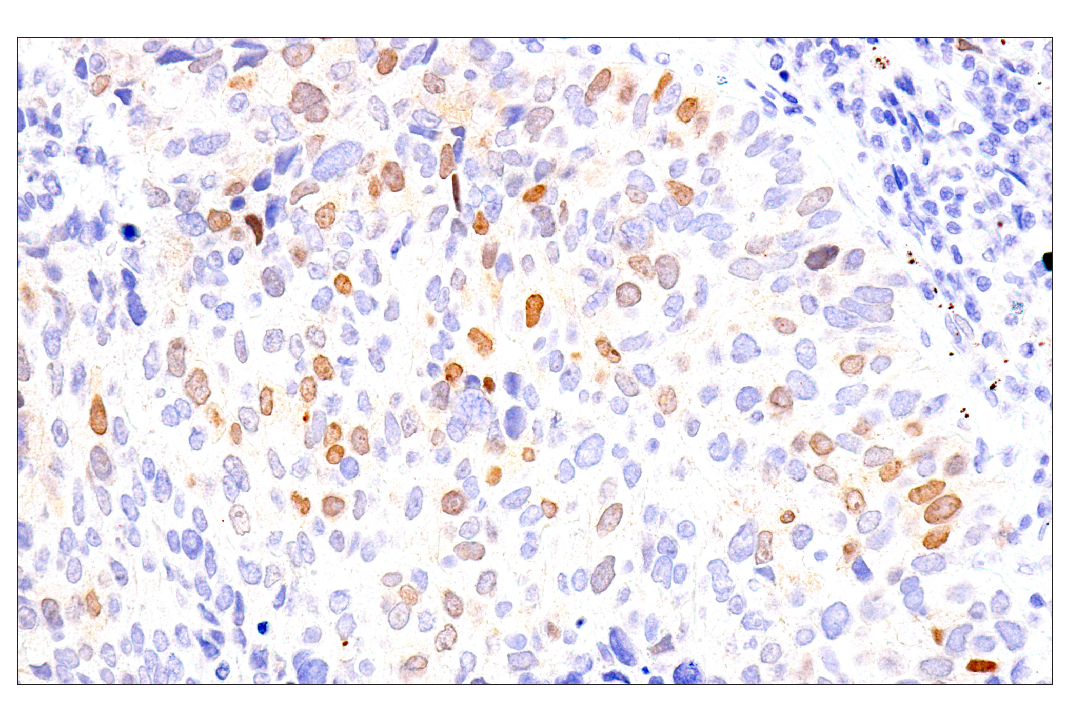 Immunohistochemistry Image 3: Chk1 (2G1D5) Mouse mAb (BSA and Azide Free)