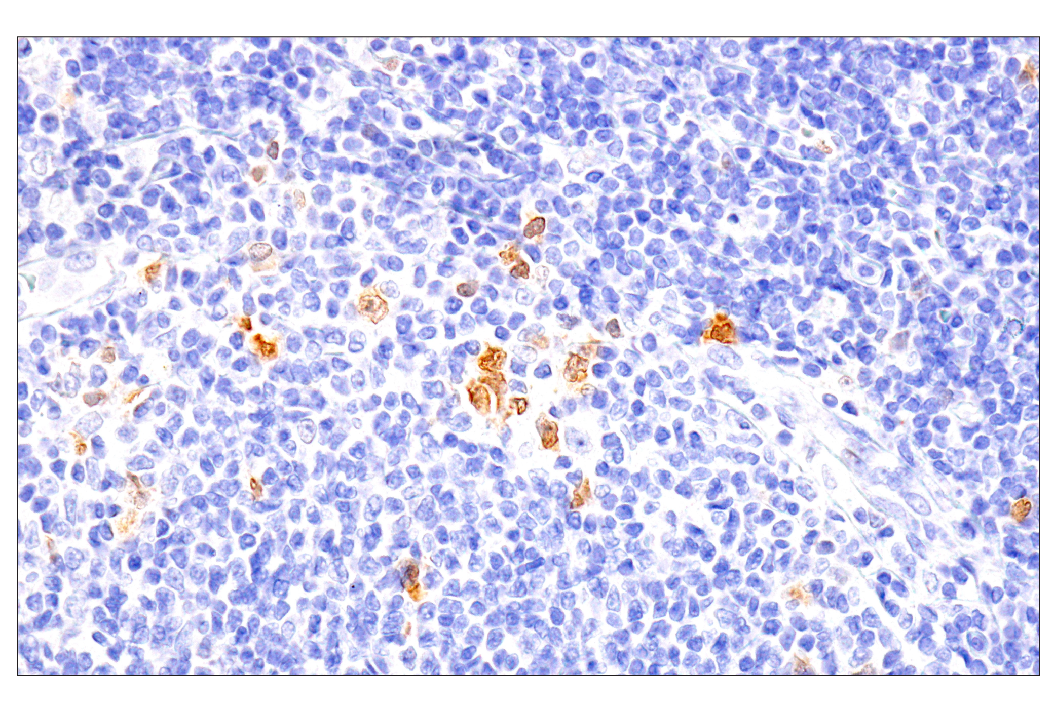 Immunohistochemistry Image 5: Chk1 (2G1D5) Mouse mAb (BSA and Azide Free)