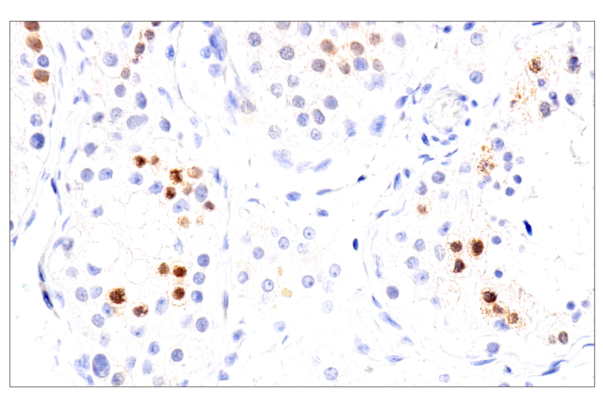 Immunohistochemistry Image 12: Chk1 (2G1D5) Mouse mAb (BSA and Azide Free)
