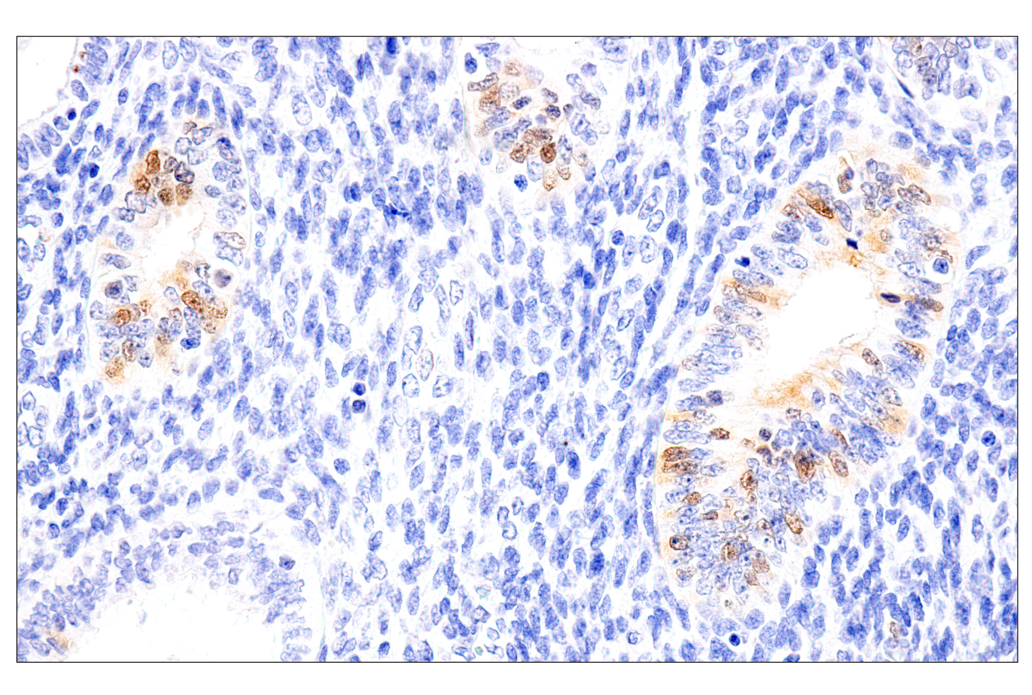 Immunohistochemistry Image 9: Chk1 (2G1D5) Mouse mAb (BSA and Azide Free)