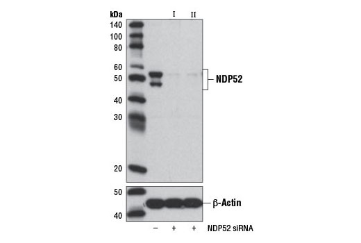  Image 1: SignalSilence® NDP52 siRNA II