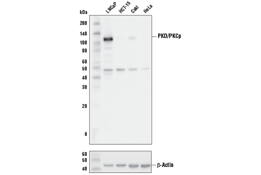  Image 4: Phospho-PKC Antibody Sampler Kit