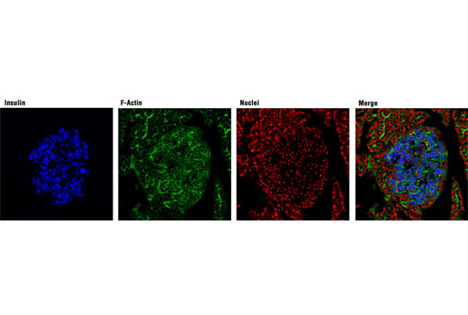 Immunofluorescence Image 1: Insulin (C27C9) Rabbit mAb (Alexa Fluor® 647 Conjugate)