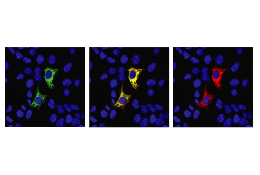 Immunofluorescence Image 1: FnCpf1 (Strain U112) (E7I2B) Rabbit mAb