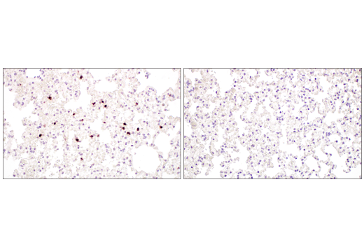 Immunohistochemistry Image 8: Neutrophil Elastase (E8U3X) Rabbit mAb