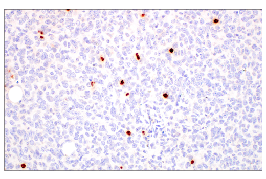Immunohistochemistry Image 6: Neutrophil Elastase (E8U3X) Rabbit mAb