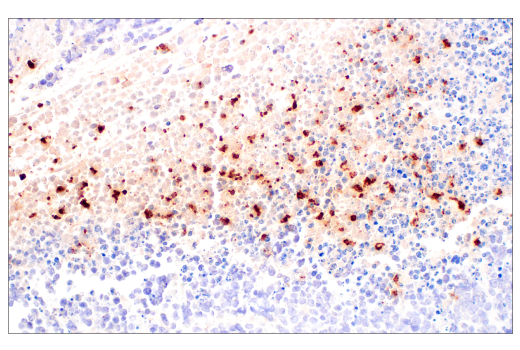 Immunohistochemistry Image 5: Neutrophil Elastase (E8U3X) Rabbit mAb