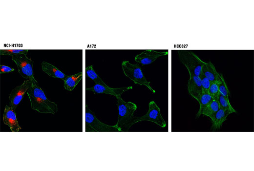 Immunofluorescence Image 1: PDGF Receptor α (D13C6) XP® Rabbit mAb (Alexa Fluor® 594 Conjugate)