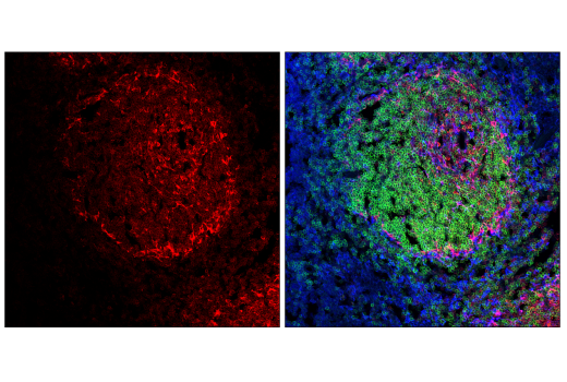 Immunofluorescence Image 1: STING (E9X7F) Rabbit mAb (Alexa Fluor® 647 Conjugate)