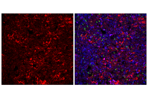 Immunofluorescence Image 2: STING (E9X7F) Rabbit mAb (Alexa Fluor® 647 Conjugate)