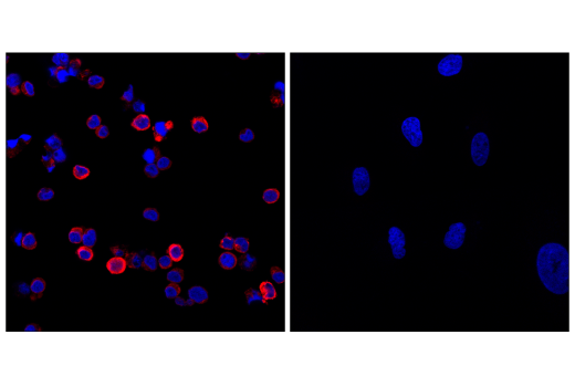 Immunofluorescence Image 3: STING (E9X7F) Rabbit mAb (Alexa Fluor® 647 Conjugate)