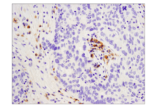 Immunohistochemistry Image 1: CD19 (Intracellular Domain) (D4V4B) XP® Rabbit mAb