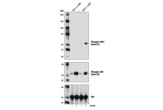  Image 20: Phospho-Akt Isoform Antibody Sampler Kit