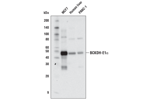  Image 5: Branched-Chain Amino Acid Metabolism Antibody Sampler Kit