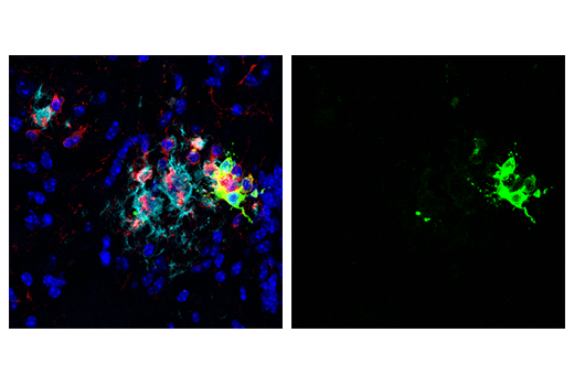 Immunofluorescence Image 1: GPNMB (E7U1Z) Rabbit mAb