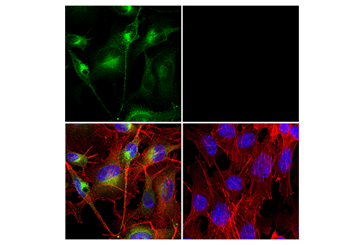 Immunofluorescence Image 2: GPNMB (E7U1Z) Rabbit mAb