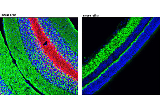  Image 9: β-Amyloid Mouse Model Neuronal Viability IF Antibody Sampler Kit