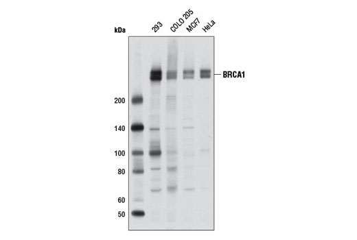 Western Blotting Image 1: BRCA1 (D54A8) Rabbit mAb