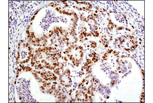 Ki 67 D2h10 Rabbit Mab Ihc Specific Cell Signaling Technology