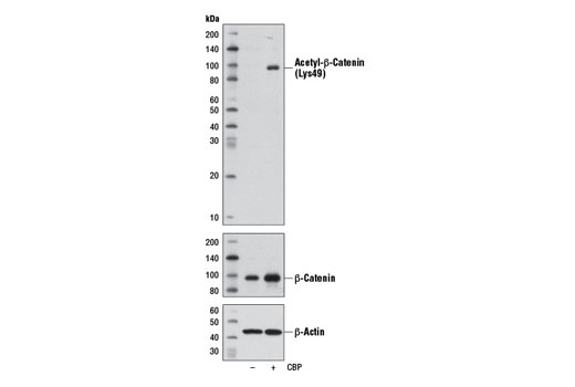 Western Blotting Image 1: Acetyl-β-Catenin (Lys49) (D7C2) Rabbit mAb