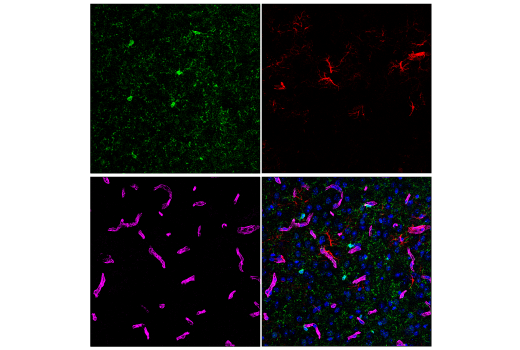Immunofluorescence Image 2: CMTM6 (E6A8T) Rabbit mAb