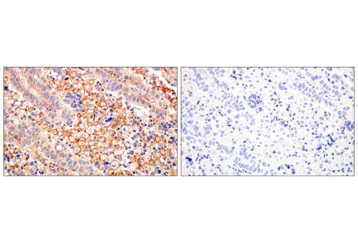 Immunohistochemistry Image 1: CMTM6 (E6A8T) Rabbit mAb