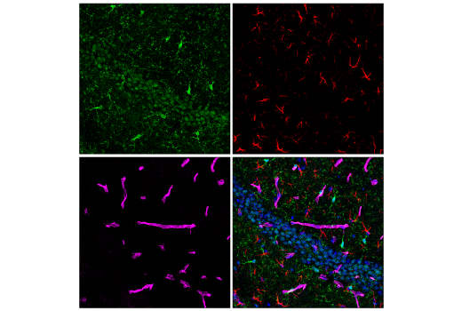 Immunofluorescence Image 4: CMTM6 (E6A8T) Rabbit mAb