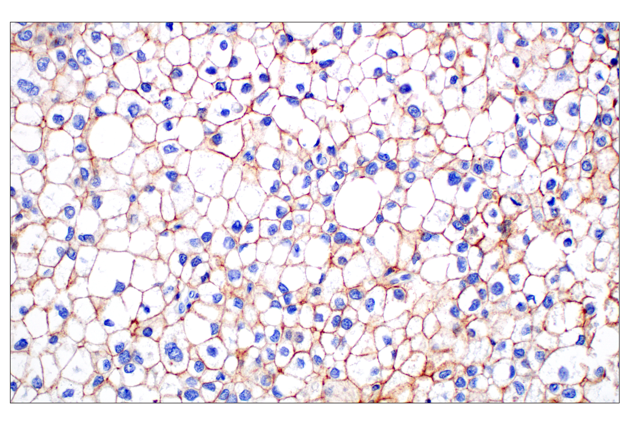 Immunohistochemistry Image 1: SCARB1 (E9H4F) Rabbit mAb