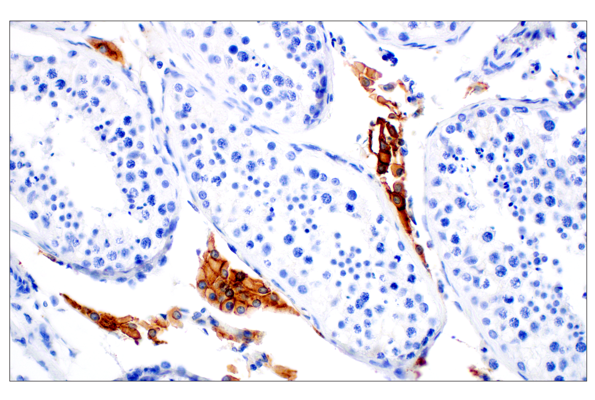 Immunohistochemistry Image 4: SCARB1 (E9H4F) Rabbit mAb
