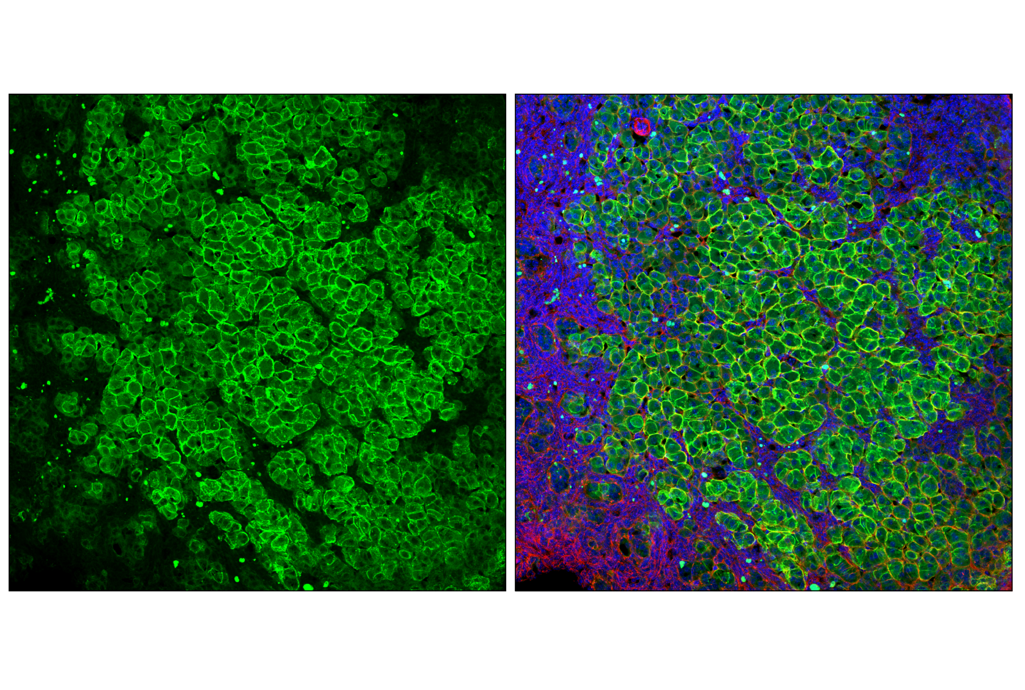 Immunofluorescence Image 1: SCARB1 (E9H4F) Rabbit mAb