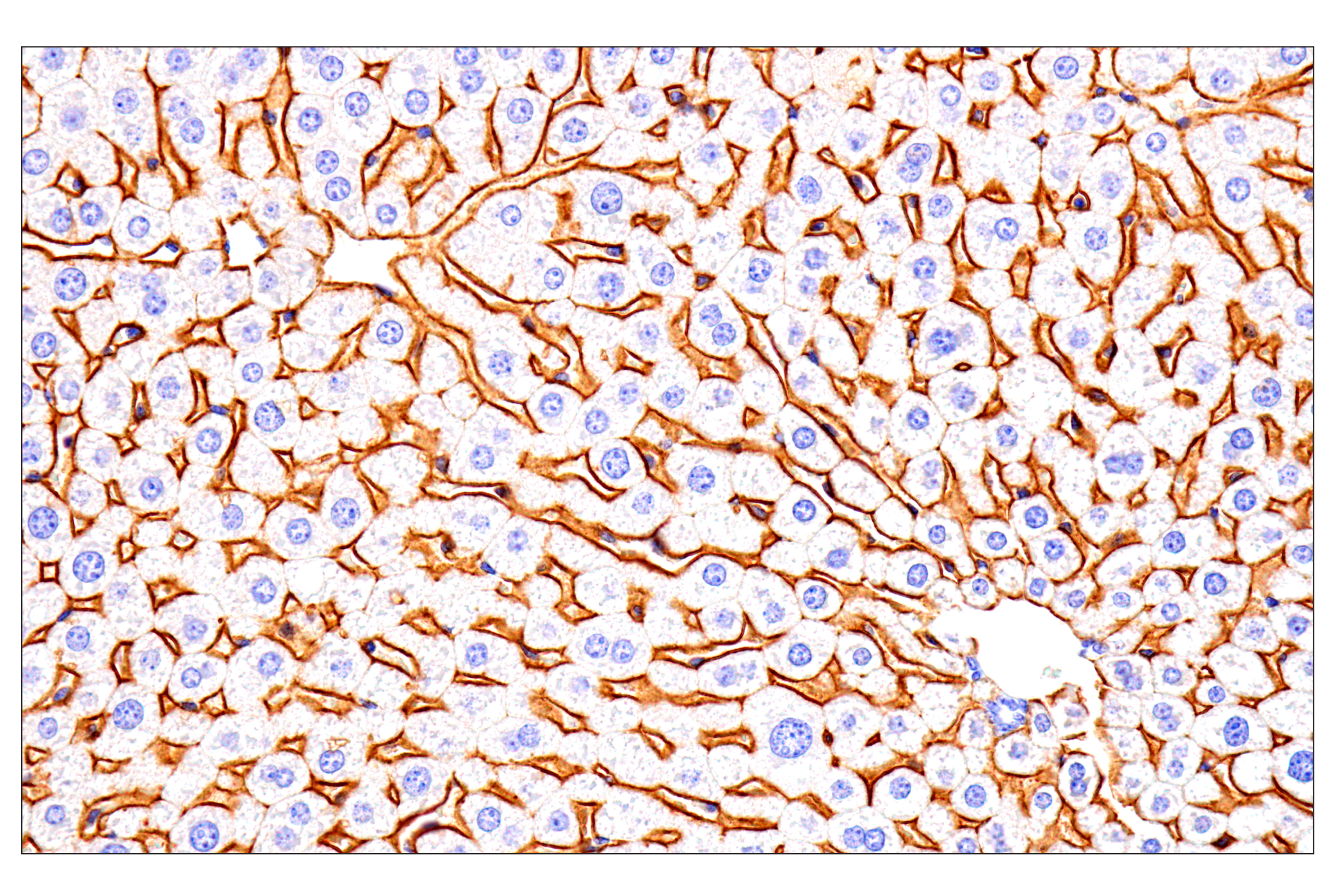 Immunohistochemistry Image 6: SCARB1 (E9H4F) Rabbit mAb