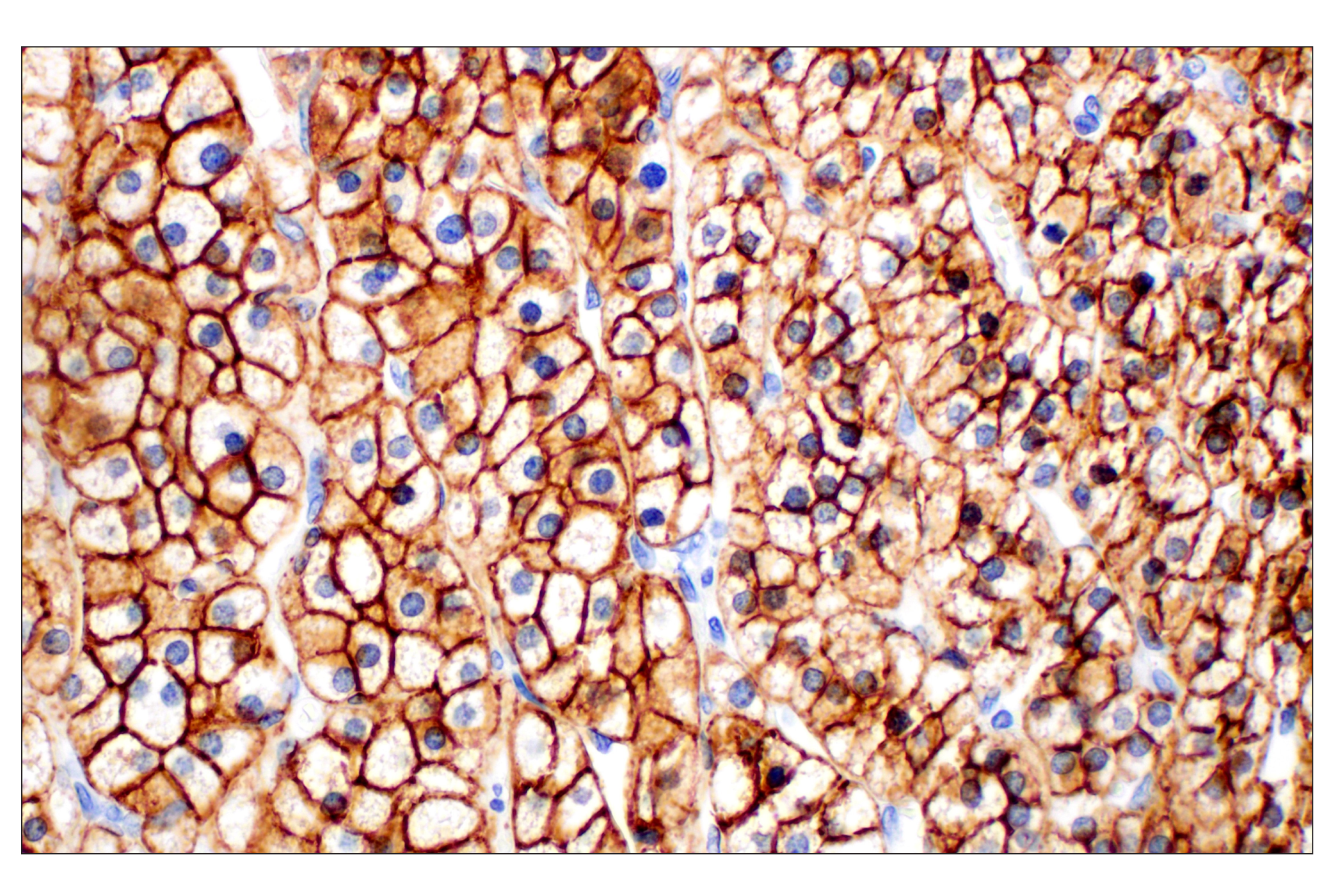 Immunohistochemistry Image 3: SCARB1 (E9H4F) Rabbit mAb