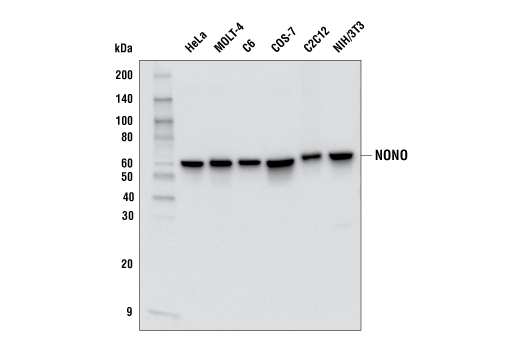Western Blotting Image 1: NONO Antibody