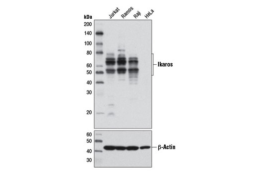 Western Blotting Image 1: Ikaros (D10E5) Rabbit mAb (BSA and Azide Free)