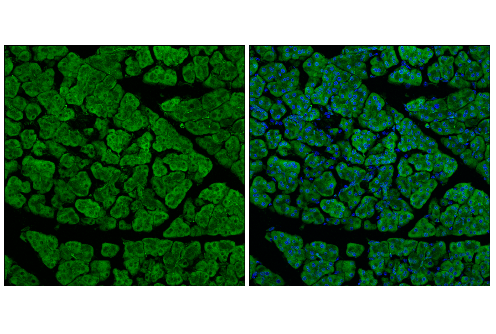 Immunofluorescence Image 1: POR (F6Y3C) Rabbit mAb