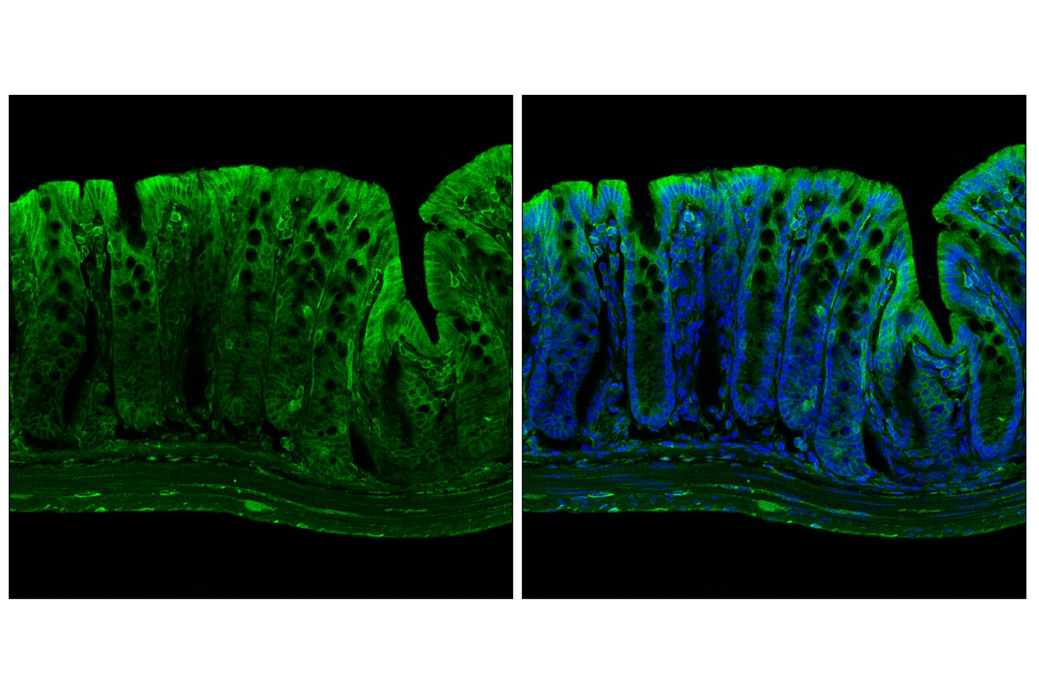 Immunofluorescence Image 2: POR (F6Y3C) Rabbit mAb