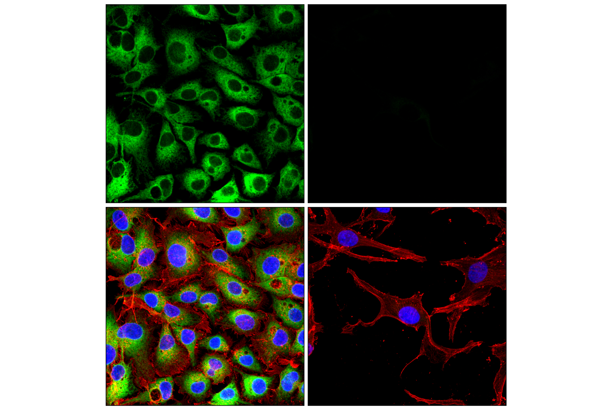 Immunofluorescence Image 3: POR (F6Y3C) Rabbit mAb