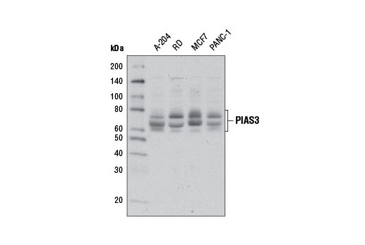 Image 11: Jak/Stat Pathway Inhibitors Antibody Sampler Kit