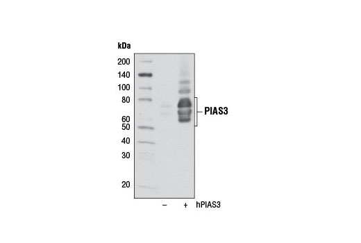  Image 14: Jak/Stat Pathway Inhibitors Antibody Sampler Kit